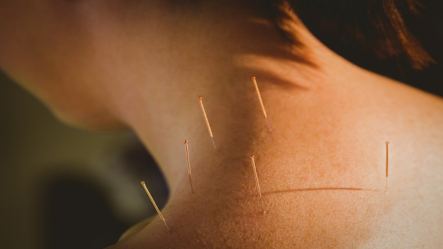 The Art of Balancing Energy: Unveiling the Secrets of Acupuncture